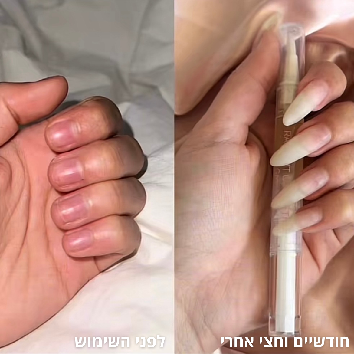 שמן צמחי לצמיחת הציפורן של NOVELA