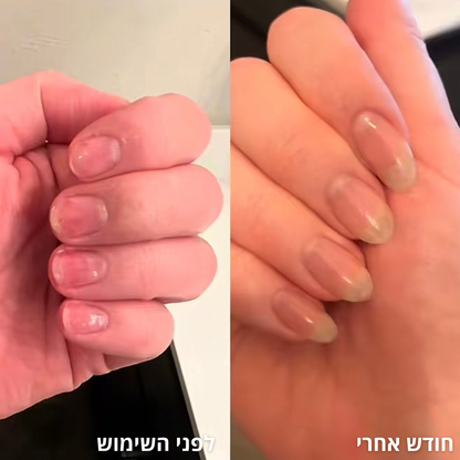 שמן צמחי לצמיחת הציפורן של NOVELA