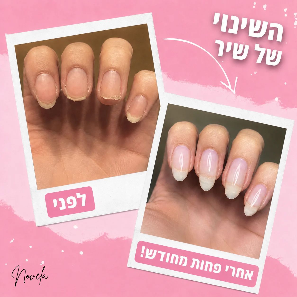 עט הויטמינים של NOVELA לשיקום מכסיסה וחיזוק הציפורן