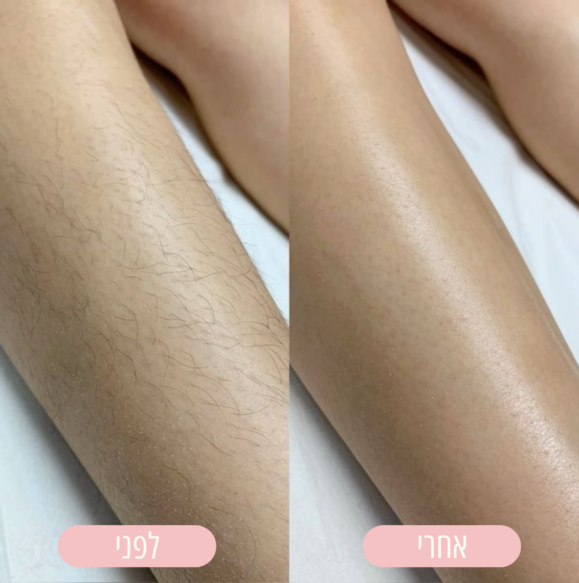 מכונת הגילוח של NOVELA