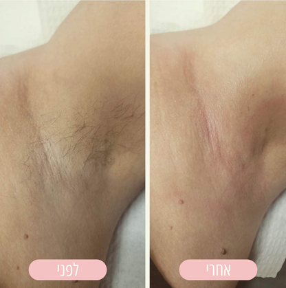 מכונת הגילוח של NOVELA