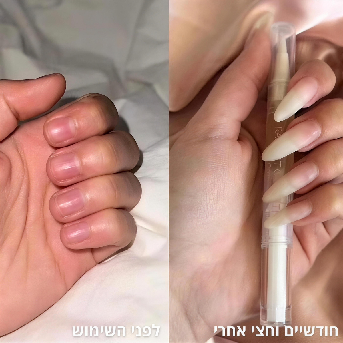 לפני השימוש ואחרי חודשיים וחצי. תמונה ששלחה לקוחה